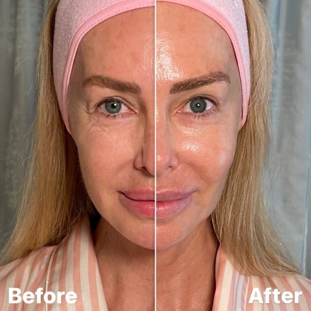 How to Improve the Quality of your Skin - Amanda Caroline Beauty